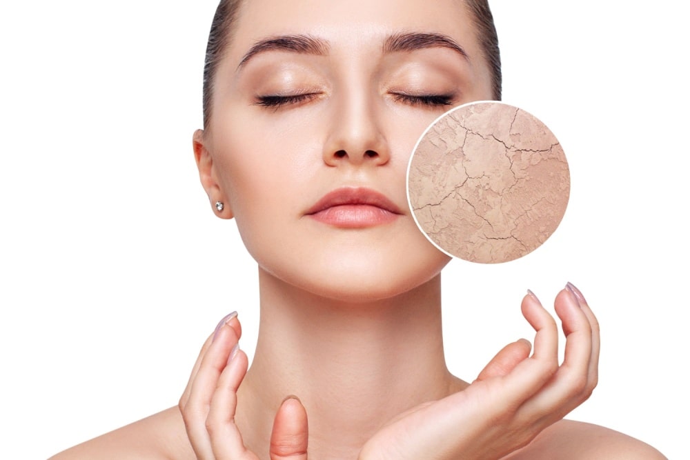 肌荒れ改善アロマブレンド総まとめ|原因別の精油選び・即効レシピ・安全な使い方まで完全ガイド